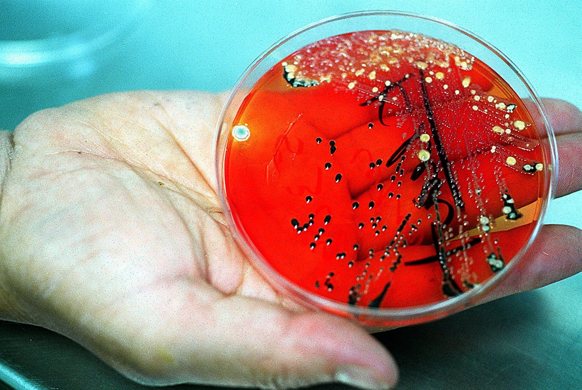 Ilustración. Científicos están preocupados por el efecto cada vez menor de los antibióticos. (Foto Hemeroteca PL).