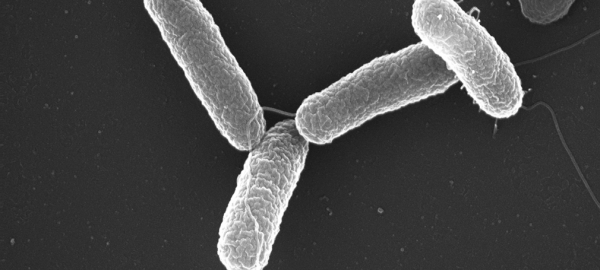 La Salmonella suele adquirirse al consumir alimentos contaminados. (Foto Prensa Libre: Hemeroteca PL)