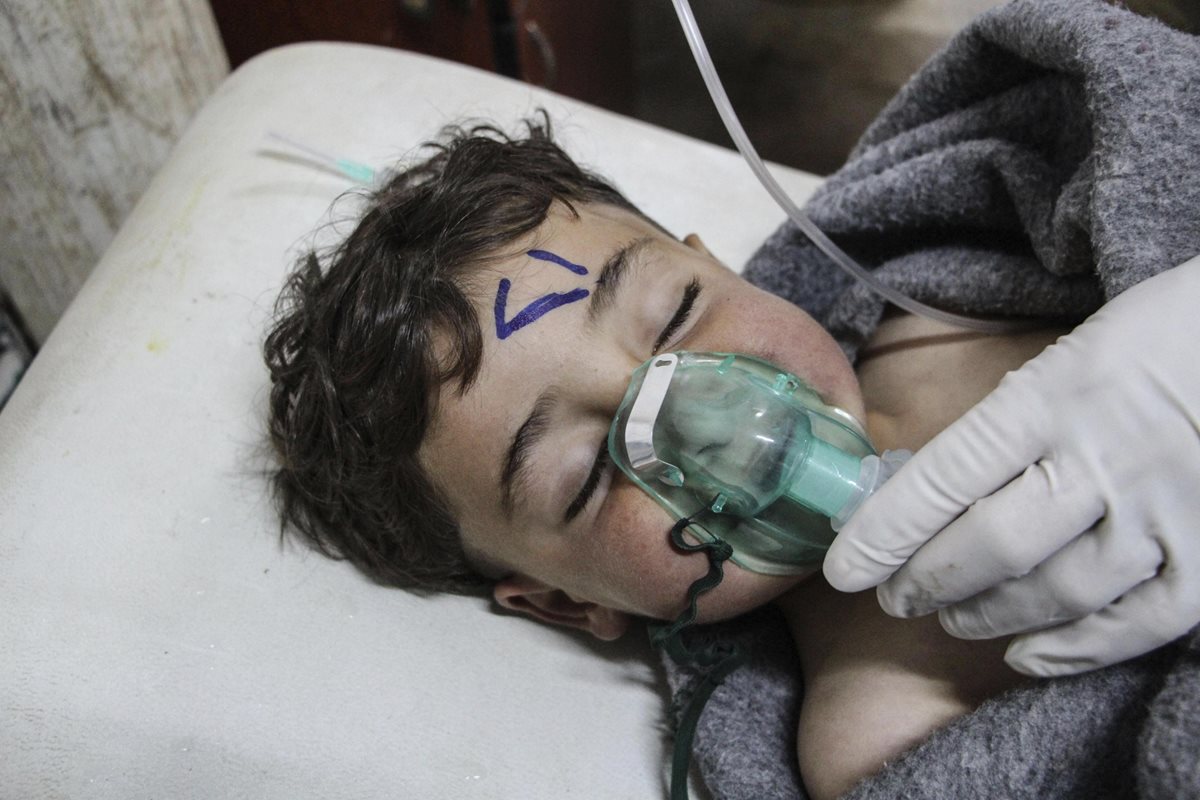 Un niño sirio recibe atención tras el supuesto ataque con armas químicas. (Foto Prensa Libre: EFE)