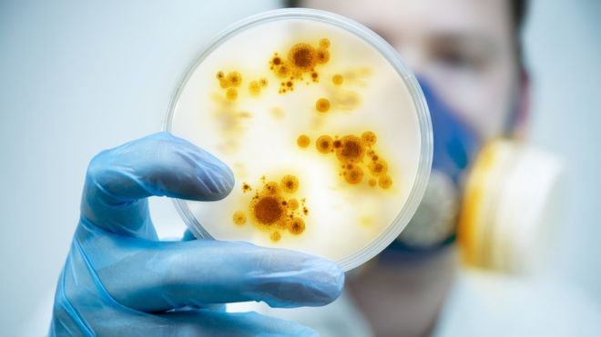 Las familias de bacterias más habituales son los Staphylococcus, Enterococcus, E. coli, Pseudomonas y Micrococcus. SOLARSEVEN / GETTY