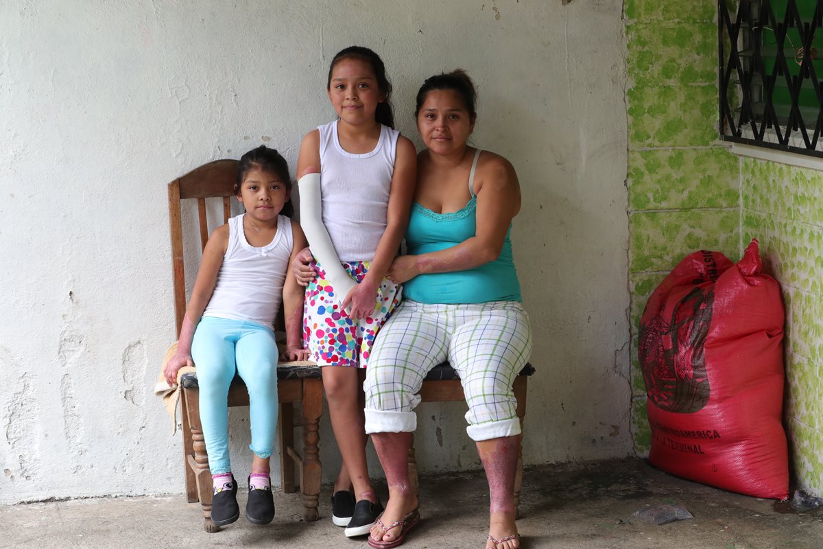 Fabiola y Kristel salieron del hospital la semana pasada. (Foto Prensa Libre: Estuardo Paredes)