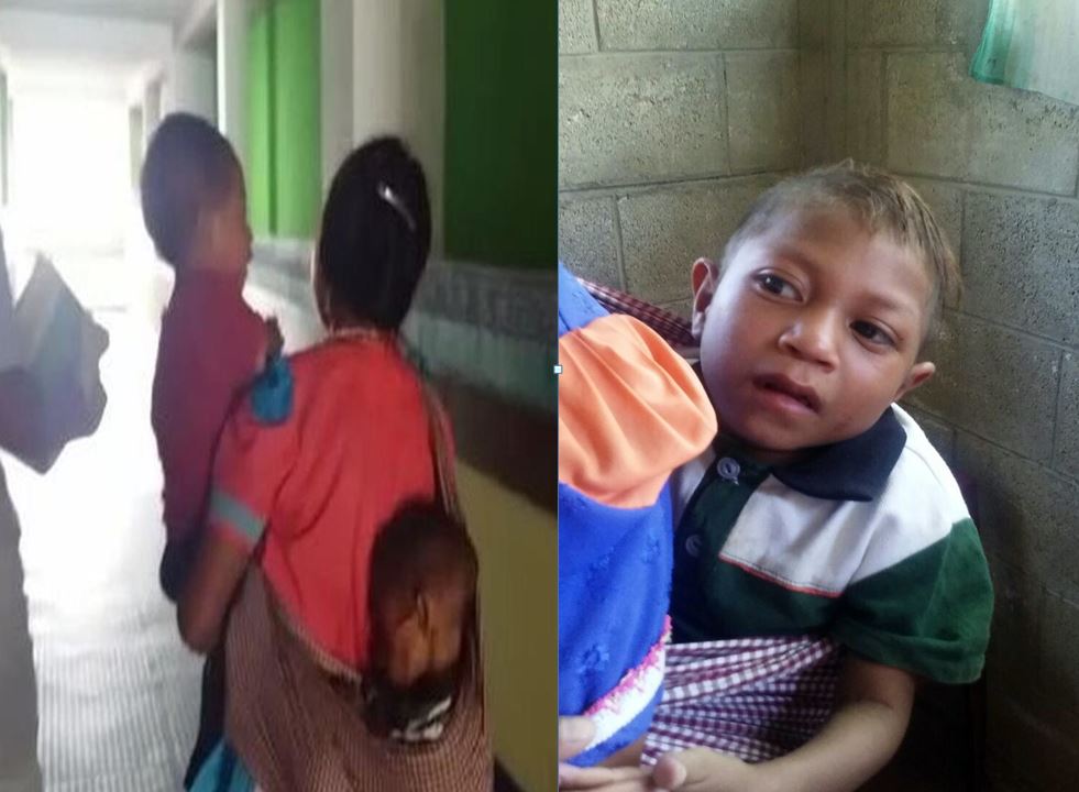 Alberto Arias Santiago, de 9 años, antes y después de haber sido recuperado de un cuadro de desnutrición severa. (Foto Prensa Libre: Astrid Morales