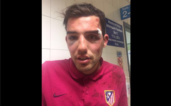 El joven aficionado del Atlético se tomó una fotografía en la sala del Hospital donde fue atendido luego de la agresión. (Foto Prensa Libre: Instagram)