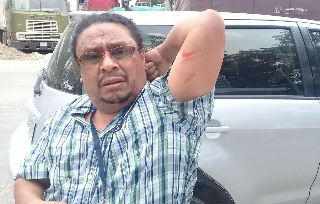 Rigoberto Escobar, corresponsal de Prensa Libre en Petén, muestra las marcas que le quedaron de la agresión. (Foto Prensa Libre: Cortesía)