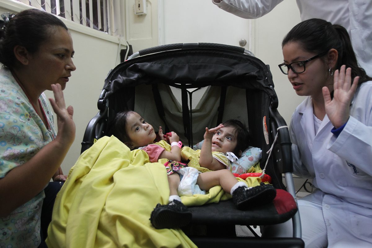 Ana Rosa y Aída Rosalin, conocidas como las Rositas, fueron poeradas en el 2015 para cepararlas. En el 2013, nacieron unidas por la pelvis. (Foto Prensa Libre: Hemeroteca)