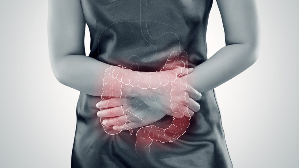 No hay una prueba concreta para diagnosticar el síndrome del colon irritable, por lo que normalmente se detecta por sus síntomas.