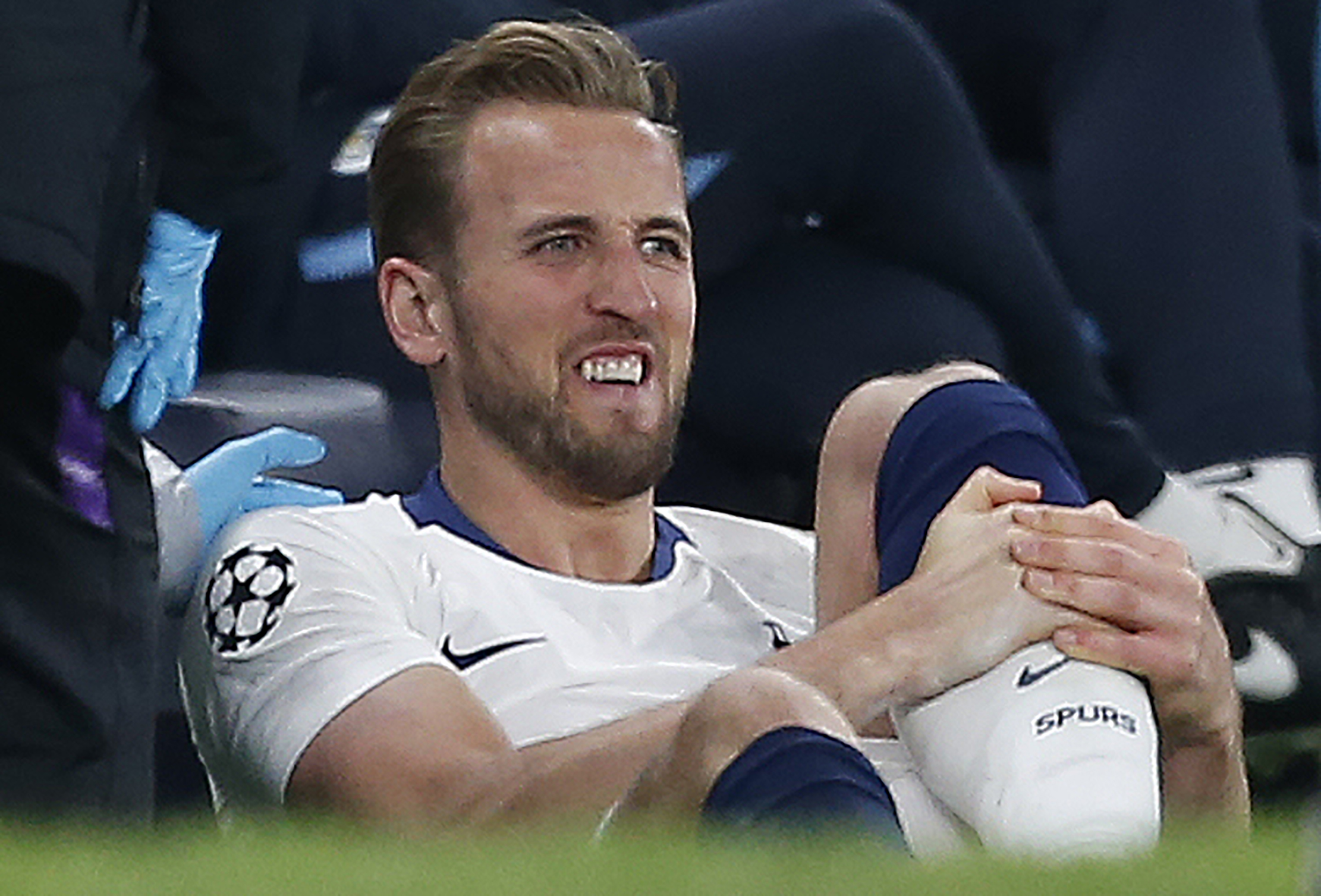 Harry Kane salió lesionado en el juego de Champions League. (Foto Prensa Libre: AFP)