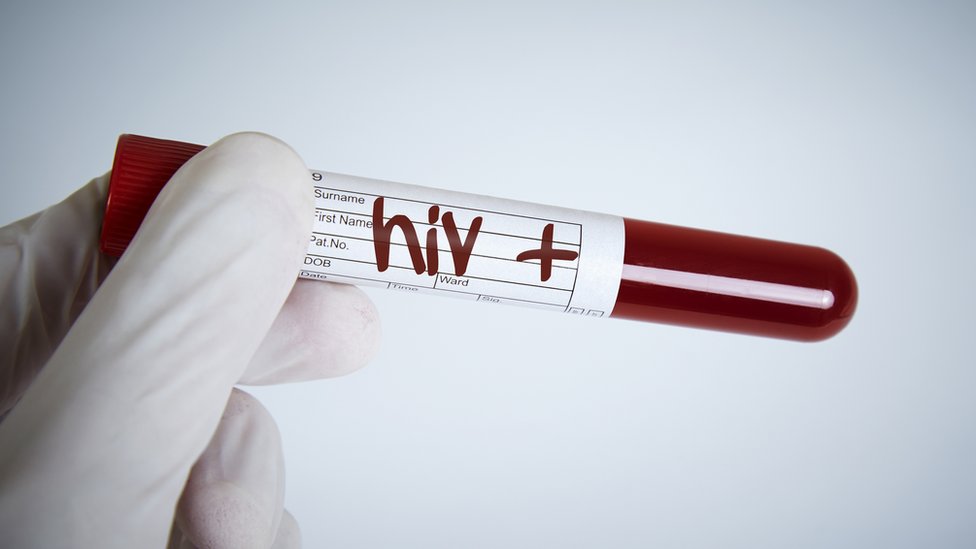 La ONU sigue trabajando para erradicar el VIH (o HIV, en inglés).