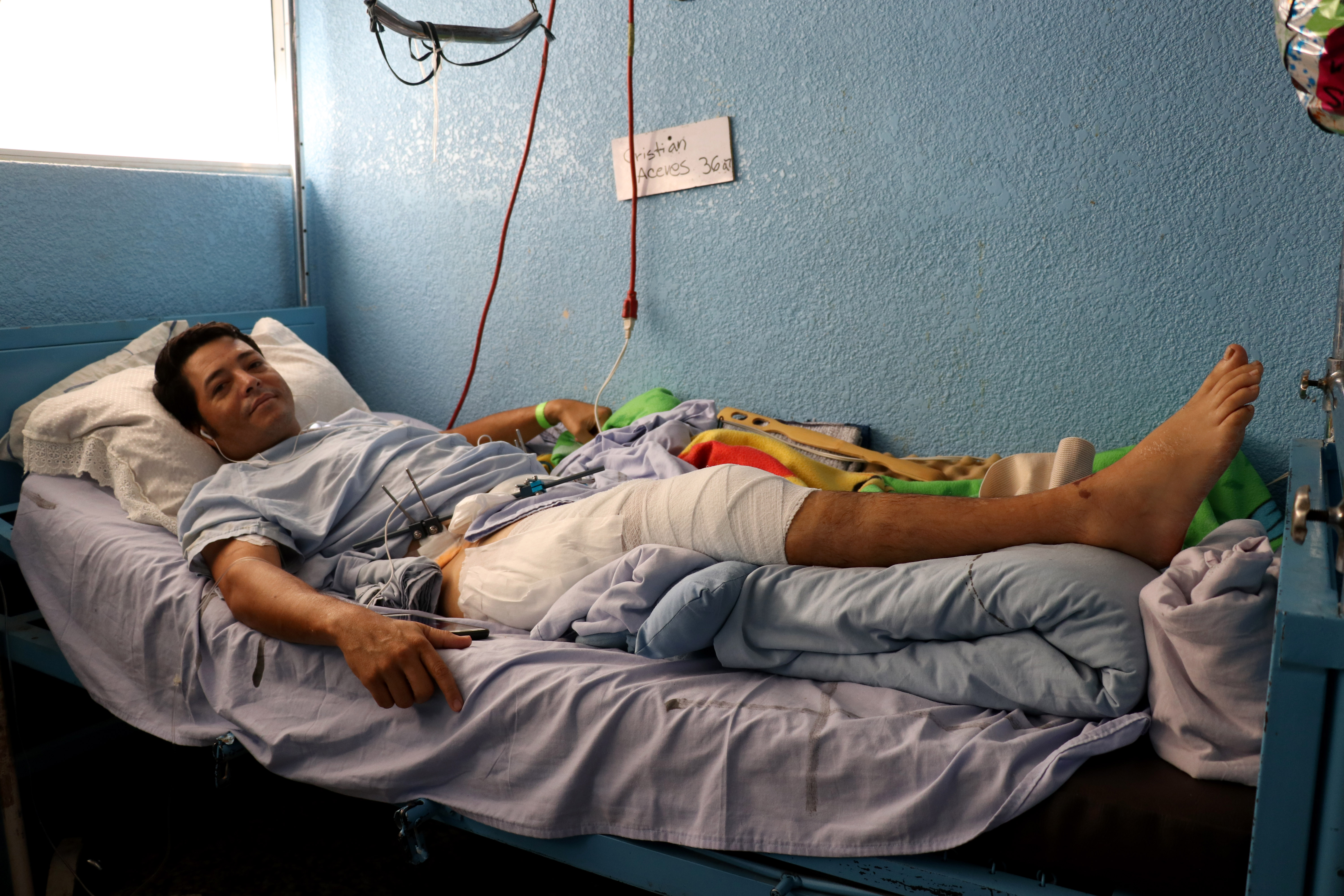 Cristian Aceves, se recupera en la sala de cirugía del Hospital Regional luego de ser operado por médicos estadounidenses. (Foto: Mike Castillo)