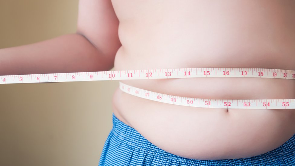 La obesidad global se triplicó desde 1975. GETTY IMAGES