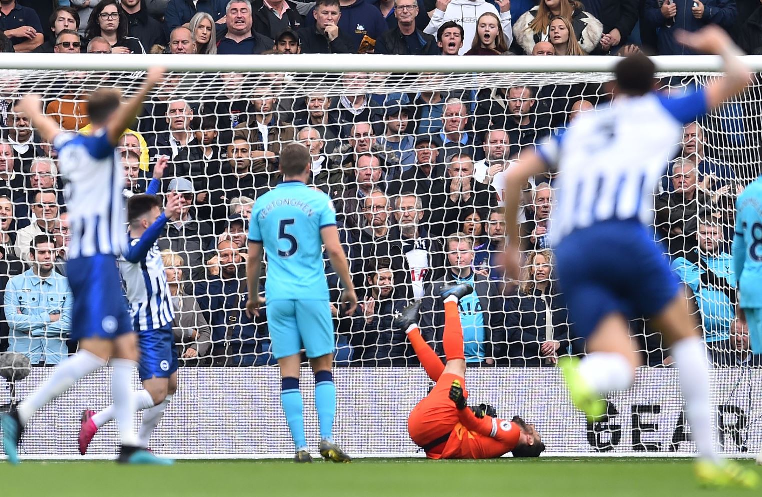 Hugo Lloris sufrió una dura lesión durante el partido de su equipo Tottenham contra el Brighton. (Foto Prensa Libre: AFP).