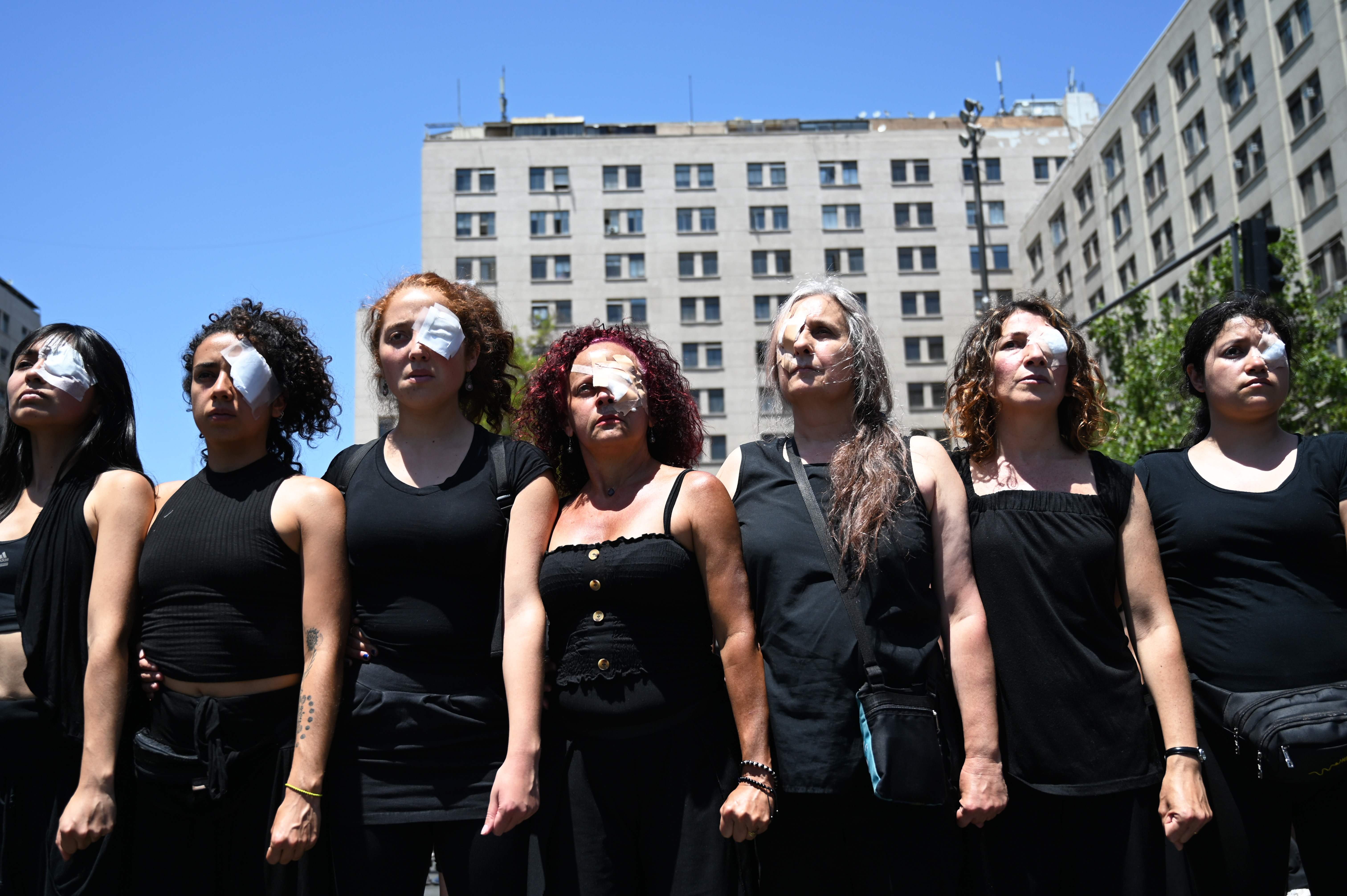 Varios manifestantes chilenos han resultado con graves heridos en los ojos luego de ataques de las autoridades.  (Foto Prensa Libre: AFP)