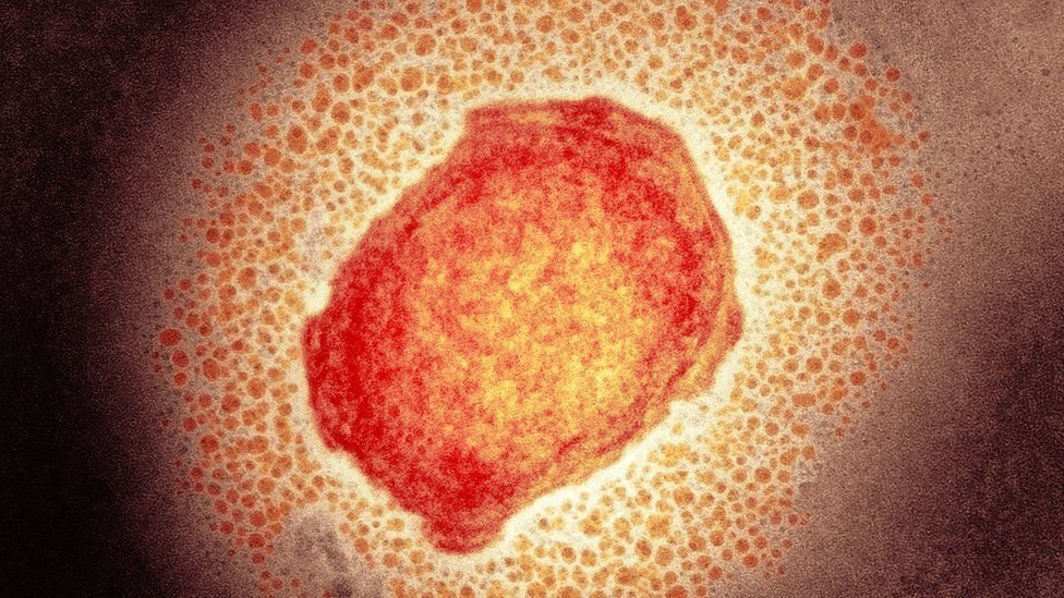 La viruela de los monos, también llamada viruela del simio o símica, es causada por un virus similar al de la viruela humana.