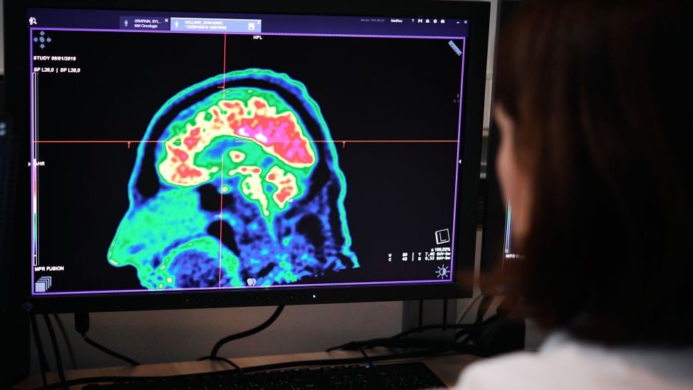 Nuestro cerebro está configurado para sobrevivir a las situaciones extremas, pero su respuesta varía en función de diversos factores. Foto:Getty Images