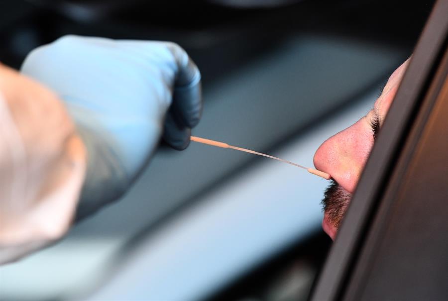 La pérdida del olfato es un síntoma de buen pronóstico del coronavirus, según investigación de la Universidad Complutense y el Hospital Clínico San Carlos de Madrid.  (Foto Prensa Libre: EFE)