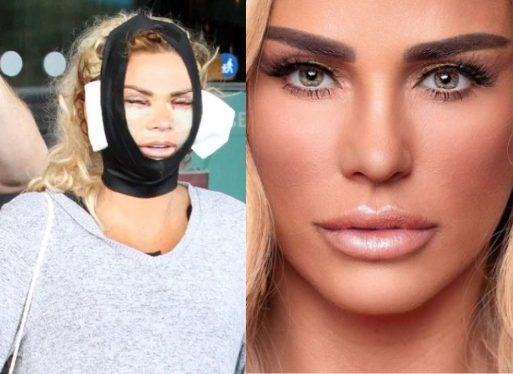 La modelo está obsesionada con la perfección y la cirugía plástica. (Fotos: izq. mui.today der. Instagram/katieprice). 