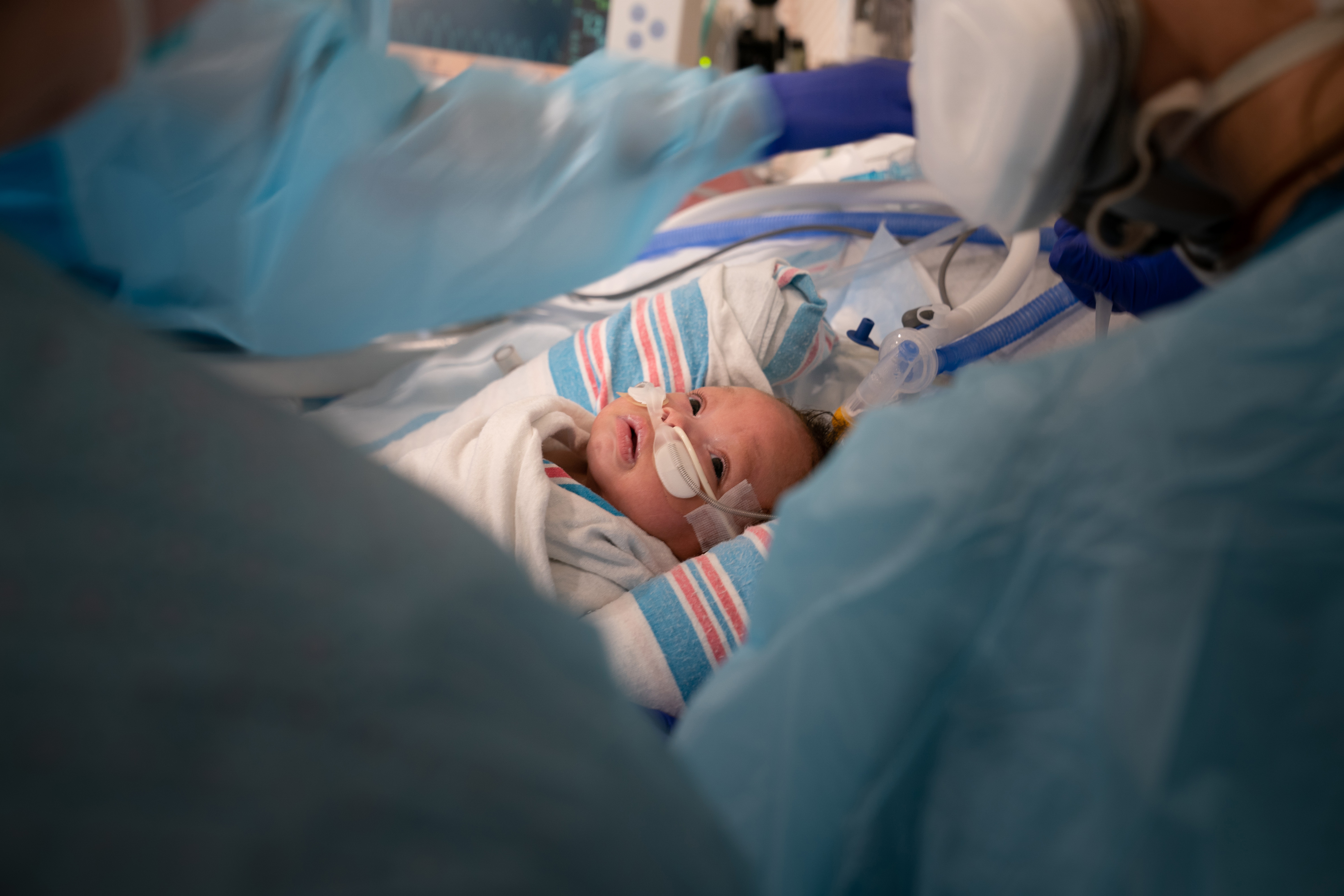 Carvase Perrilloux Jr., de dos meses, en el Hospital de Niños de Nueva Orleans el 20 de agosto de 2021. (Foto Prensa Libre: Erin Schaff / The New York Times)