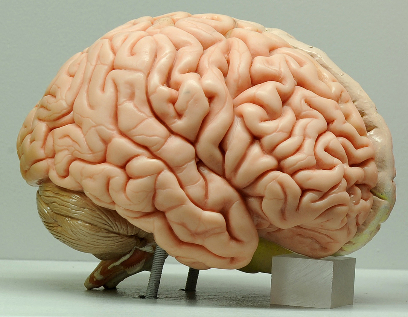 cerebro