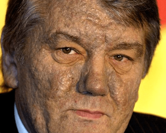 Viktor Yushchenko