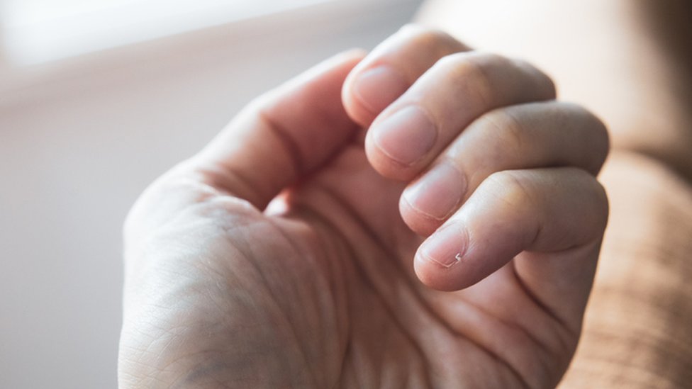 Es importante prestar atención a los cambios de color y la aparición de manchas en las uñas.