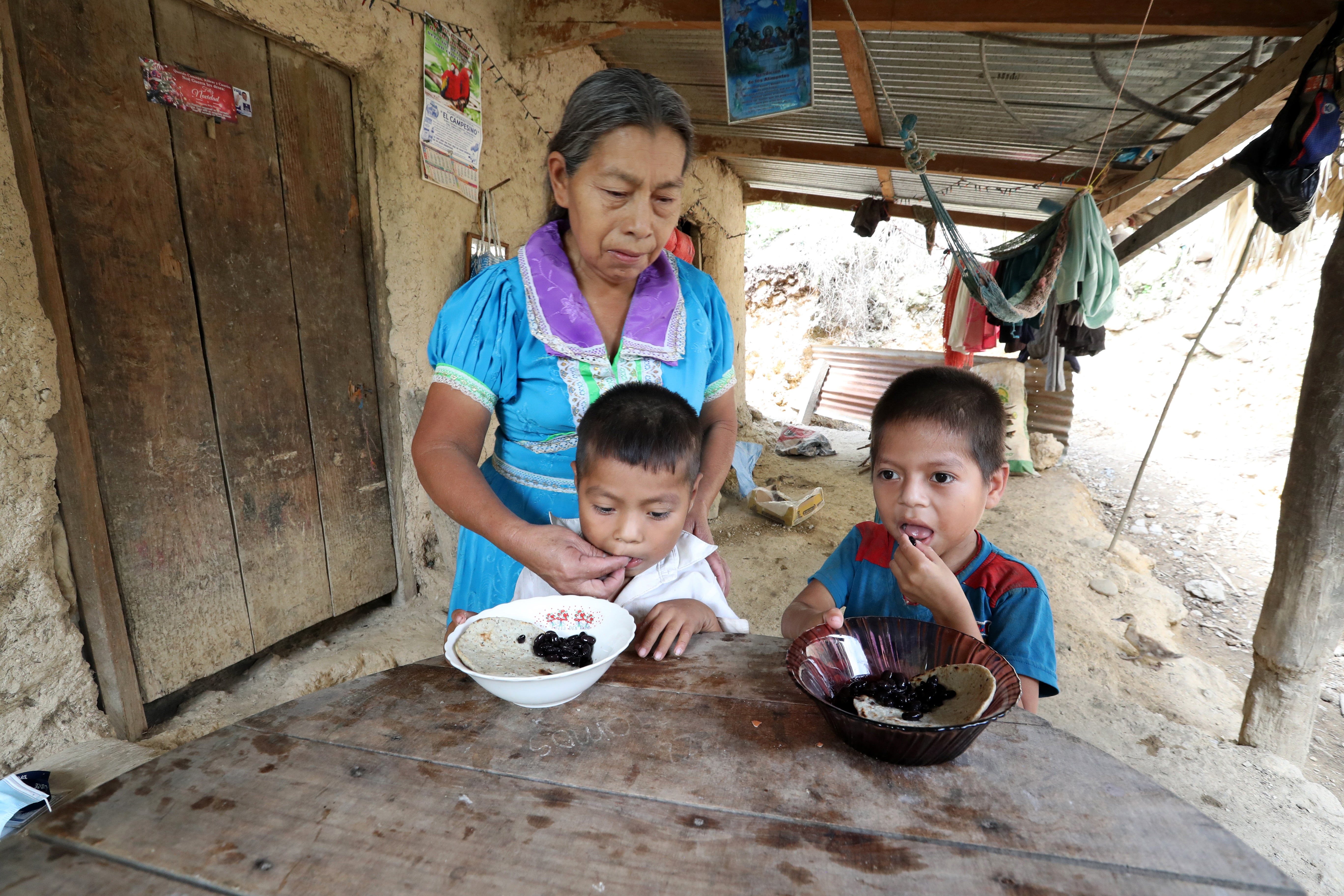 desnutrición, chiquimula, hambre, inseguridad alimentaria