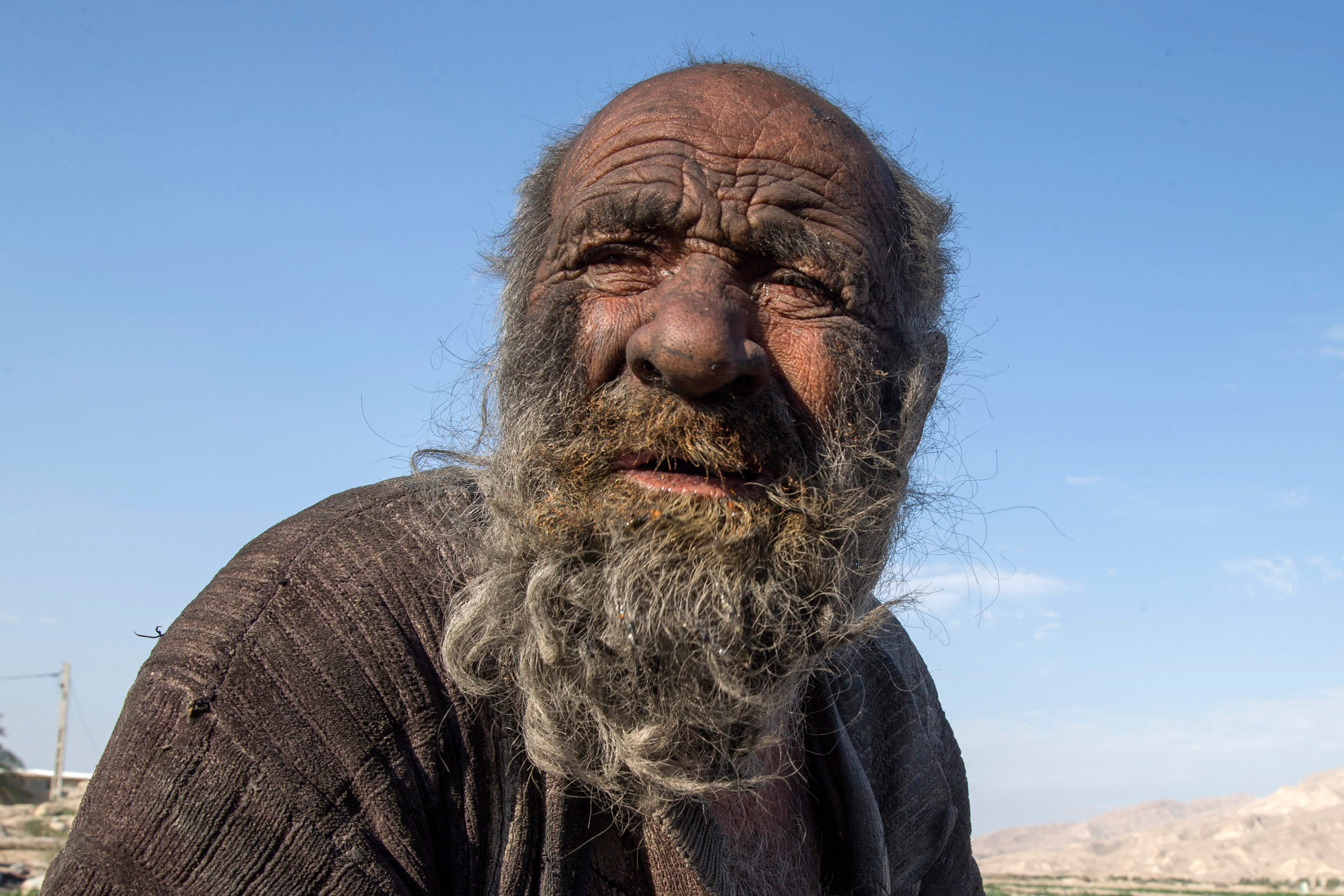 El hombre más sucio del mundo