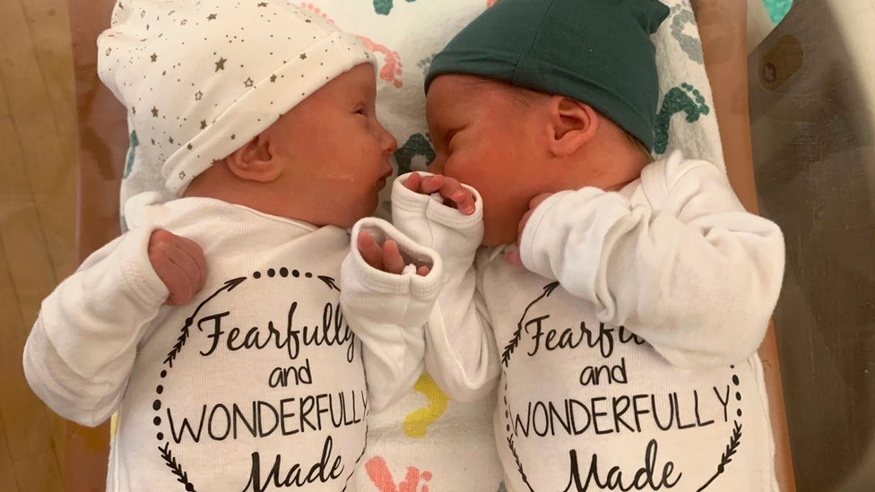 Lydia Ann y Timothy Ronald Ridgeway nacieron el 31 de octubre de 2022.