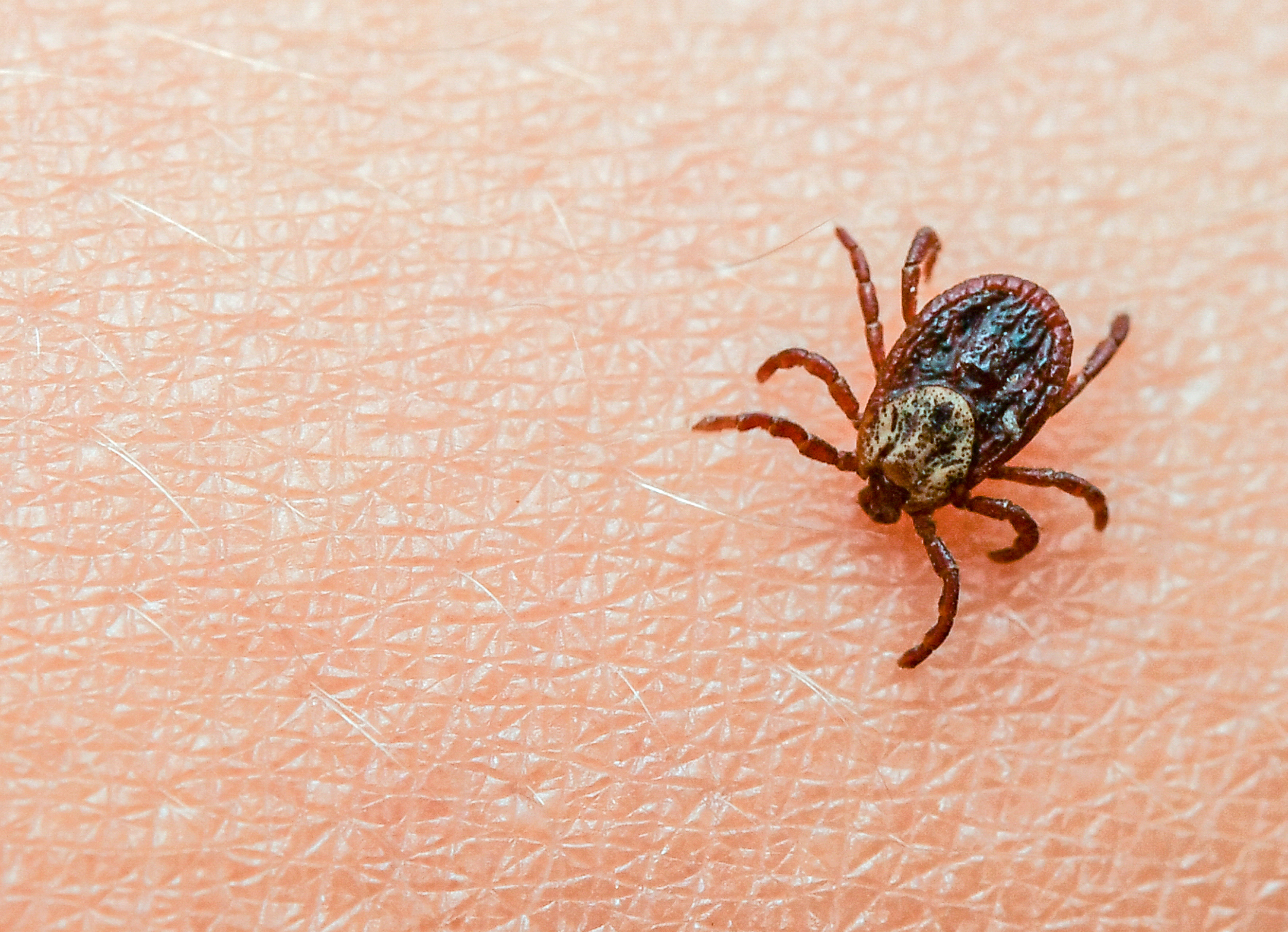 Picadura de garrapata: Qué se debe hacer de inmediato