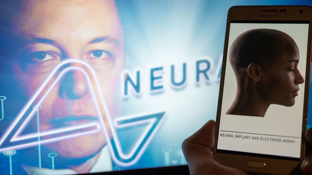 Neuralink es una compañía de neurotecnología especializada en el desarrollo de interfaces cerebro-computador.