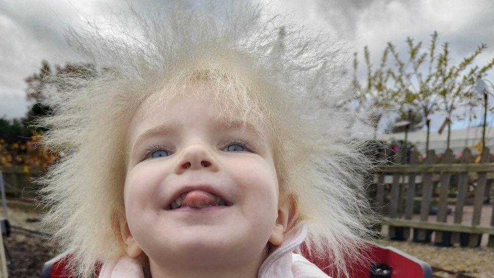 Layla dice que le encanta su cabello.
Cortesía de la familia