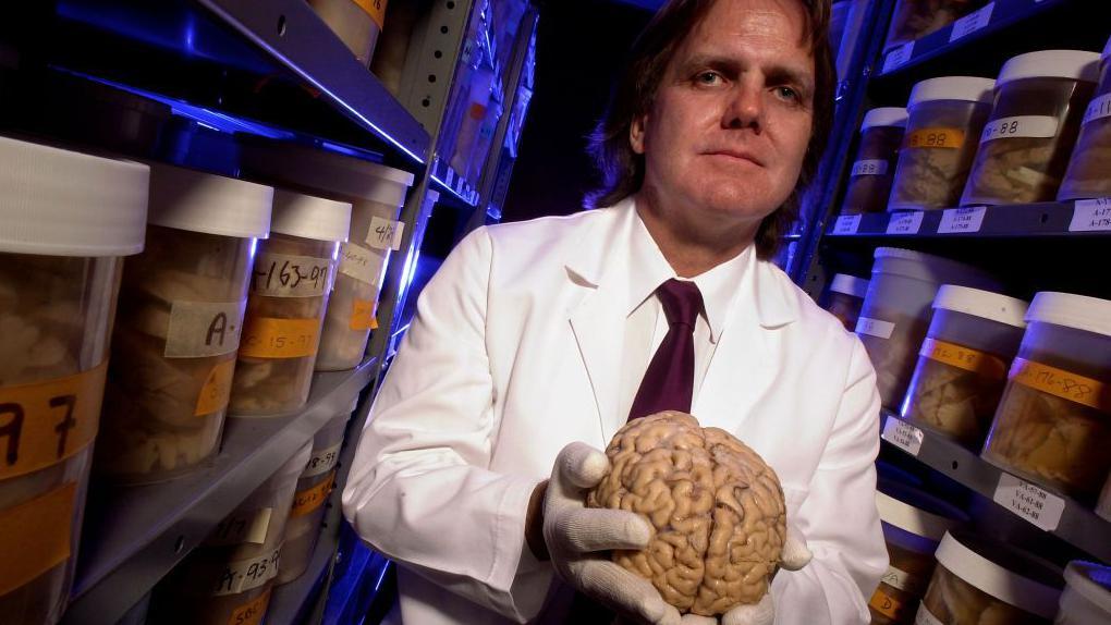 David Snowdon con la colección de cerebros de donantes para su estudio realizado con la colaboración de las Hermanas Escolares de Nuestra Señora.
Getty Images