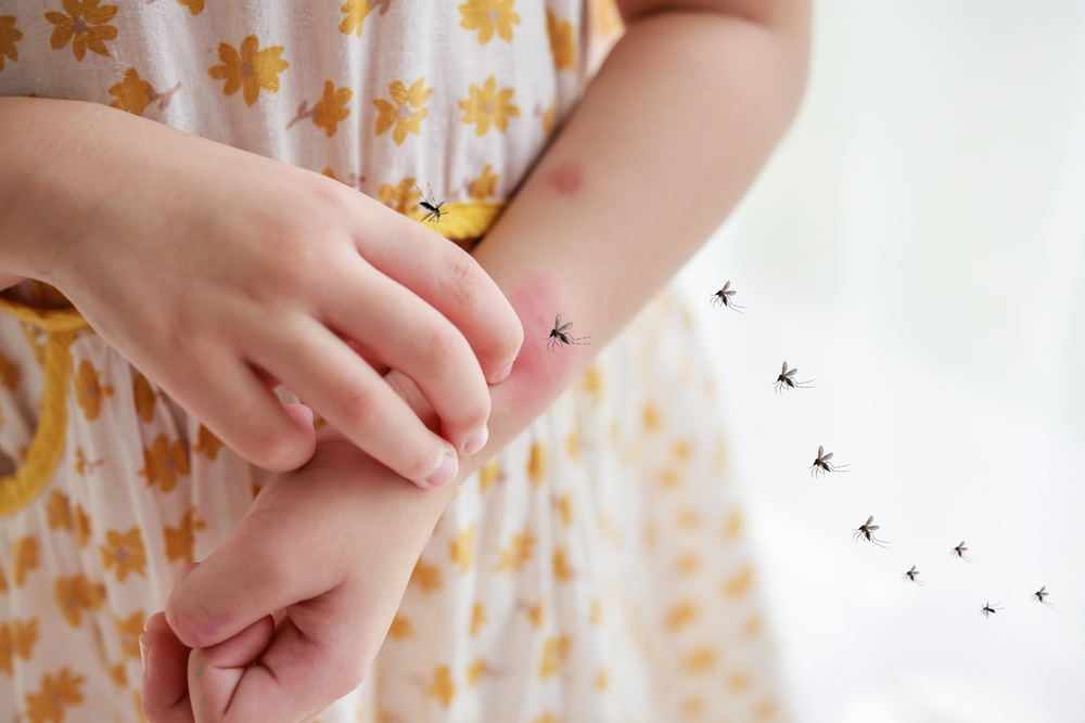 Niña con picadura de mosquitos