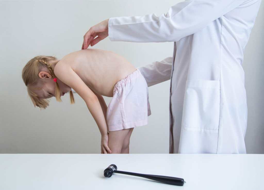 Un médico ortopédico examina a una niña que tiene dolor de espalda al torcer y alargarla la espalda. Escoliosis en niños, síndrome miofascial, kyphoscoliosis