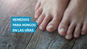 Los hongos en las uñas de los pies son infecciones comunes que pueden reaparecer si no se tratan de forma adecuada. La Clínica Mayo recomienda opciones médicas como pastillas antimicóticas o esmaltes especializados, y también existen remedios caseros —como aceites esenciales o vinagre— que pueden complementar el tratamiento bajo orientación profesional.