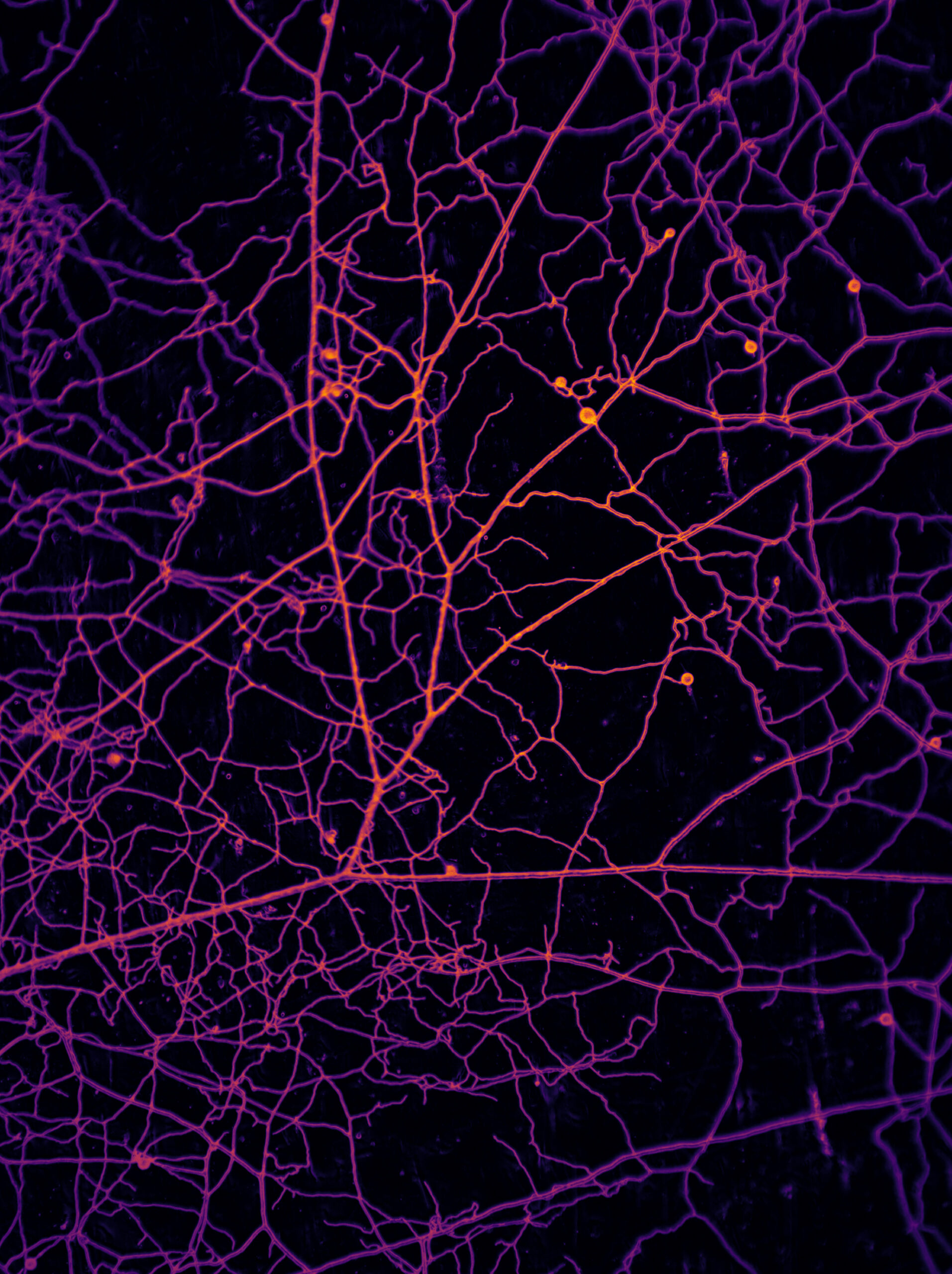 In an undated image provided by Loreto Oyarte Gálvez/VU Amsterdam/AMOLF/SPUN, lab-grown fungal samples photographed with a high-tech imaging robot to make high-resolution images of the hyphae. With machine learning and a high-resolution imaging robot, scientists measured and mapped the extent of Earth's carbon circulatory system. (Loreto Oyarte Gálvez/VU Amsterdam/AMOLF/SPUN via The New York Times) -- NO SALES; FOR EDITORIAL USE ONLY WITH NYT STORY FUNGI NETWORKS BY EMILY ANTHES FOR JUNE 11, 2026. ALL OTHER USE PROHIBITED. --